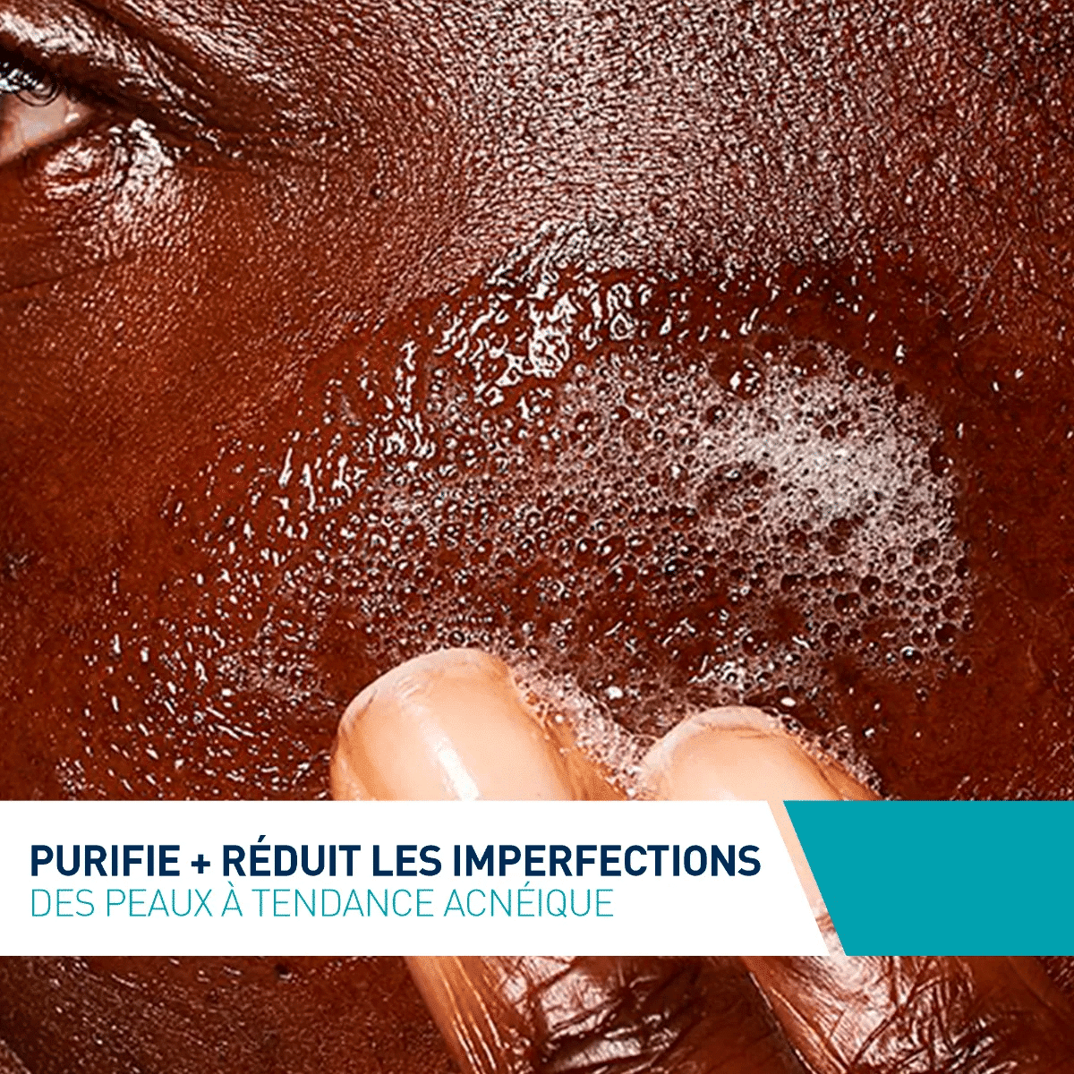 CeraVe Gel Moussant Anti Imperfections 236ml - Peaux Acnéiques & Pores