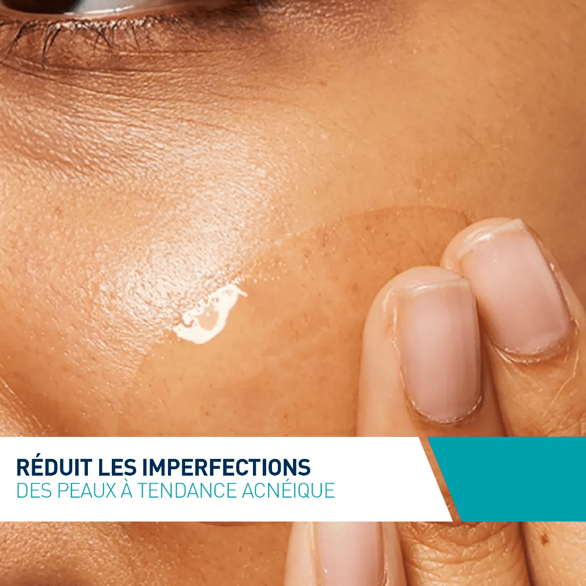 CeraVe Soin Anti-Imperfections 40ml - AHA, BHA & Céramides
